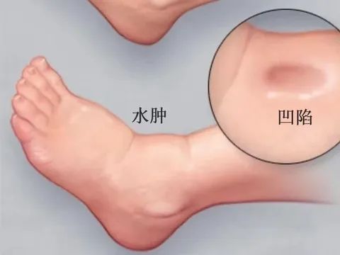 健身营养餐食谱大全_健身人手没营养圈_健身营养餐怎么做